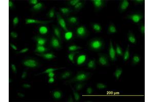 Immunofluorescence of monoclonal antibody to ZWINT on HeLa cell. (ZWINT 抗体  (AA 1-277))