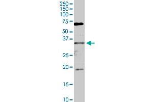 FHL2 MaxPab rabbit polyclonal antibody. (FHL2 抗体  (AA 1-279))