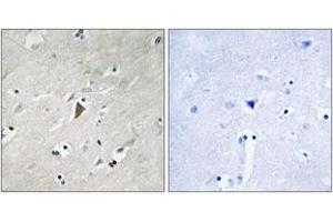 Immunohistochemistry analysis of paraffin-embedded human brain, using PDK1 (Phospho-Tyr9) Antibody.