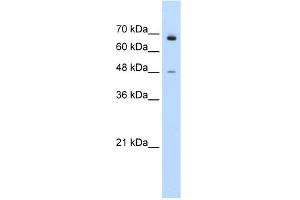 WB Suggested Anti-KLHL25 Antibody Titration:  0. (KLHL25 抗体  (N-Term))