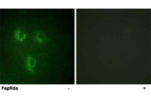 Immunofluorescence analysis of HUVEC cells, using PMEPA1 polyclonal antibody . (PMEPA1 抗体)