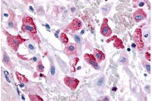 Human Uterus, Pregnant (formalin-fixed, paraffin-embedded) stained with BRS3 antibody ABIN213491 at 10 ug/ml followed by biotinylated goat anti-rabbit IgG secondary antibody ABIN481713, alkaline phosphatase-streptavidin and chromogen. (BRS3 抗体  (Cytoplasmic Domain))