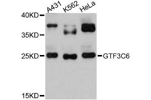 Western blot analysis of extracts of various cell lines, using GTF3C6 antibody (ABIN6294075) at 1:3000 dilution.