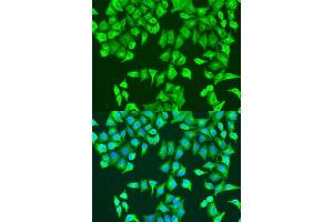 Immunofluorescence analysis of U2OS cells using RhoA antibody (ABIN7269865) at dilution of 1:100. (RHOA 抗体  (AA 1-193))