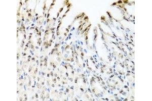 Immunohistochemistry (Paraffin-embedded Sections) (IHC (p)) image for anti-YTH Domain Family, Member 3 (YTHDF3) antibody (ABIN7264421)