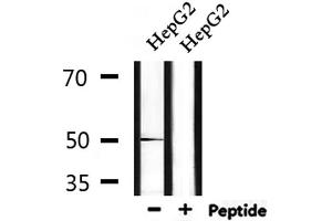 Western blot analysis of extracts from HepG2, using FOXA1 Antibody.
