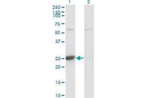 Western Blot analysis of TK1 expression in transfected 293T cell line by TK1 monoclonal antibody (M06), clone 3E2. (TK1 抗体  (AA 1-234))
