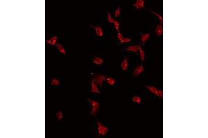 ABIN6275013 staining Hela by IF/ICC. (CKLF 抗体)