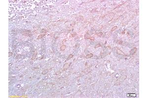 Formalin-fixed and paraffin embedded rat brain labeled with Rabbit Anti 5-HTR2A/HTR2A Polyclonal Antibody, Unconjugated (ABIN737016) at 1:200 followed by conjugation to the secondary antibody and DAB staining