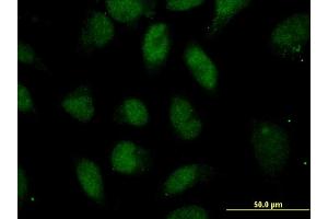 Immunofluorescence of monoclonal antibody to POU5F1 on HeLa cell.