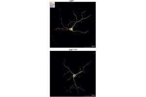 Dissociated hippocampal neurons isolated from P0 Emx1Cre:R26P1 and Emx1Cre,R26P1R203W mice were processed for confocal imaging at DIV18 to detect MAP2 (magenta), HA-tagged PACS1 or PACS1R203W (pseudocolored green), PSD95 (cat.