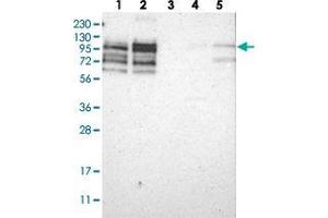 Western blot analysis of Lane 1: RT-4, Lane 2: U-251 MG, Lane 3: Human Plasma, Lane 4: Liver, Lane 5: Tonsil with PPP1R13B polyclonal antibody  at 1:250-1:500 dilution. (PPP1R13B 抗体)