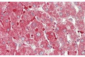 Detection of CPT1A in Human Liver Tissue using Polyclonal Antibody to Carnitine Palmitoyltransferase 1A, Liver (CPT1A) (CPT1A 抗体  (AA 191-353))