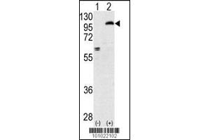 Western blot analysis of PRKCE using rabbit polyclonal PKC epsilon Antibody using 293 cell lysates (2 ug/lane) either nontransfected (Lane 1) or transiently transfected with the PRKCE gene (Lane 2). (PKC epsilon 抗体  (N-Term))