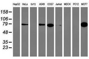 Image no. 1 for anti-phosphofructokinase, Platelet (PFKP) antibody (ABIN1500166) (PFKP 抗体)