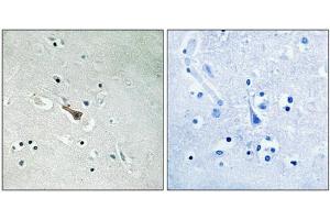 Immunohistochemical analysis of paraffin-embedded human brain tissue using APLP2 (Phospho-Tyr755) antibody (left)or the same antibody preincubated with blocking peptide (right). (APLP2 抗体  (pTyr755))