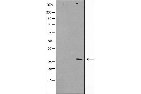 KDELR3 抗体  (Internal Region)