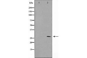 Western blot analysis on NIH-3T3 cell lysate using ERD23 Antibody (KDELR3 抗体  (Internal Region))