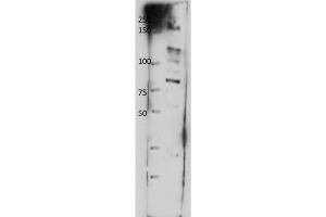Western Blotting (WB) image for anti-ATP-Binding Cassette, Sub-Family B (MDR/TAP), Member 8 (ABCB8) (Internal Region) antibody (ABIN5596884)