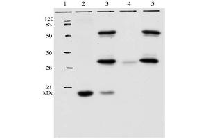 IP analysis of HPV-11 E7 protein. (Human Papilloma Virus 11 E7 (HPV-11 E7) (AA 36-70) 抗体)