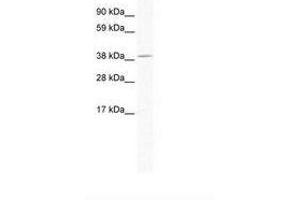 Image no. 1 for anti-Protein Tob1 (TOB1) (AA 173-222) antibody (ABIN202348) (Protein Tob1 (TOB1) (AA 173-222) 抗体)