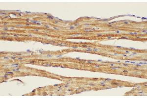Immunohistochemistry of paraffin-embedded Mouse heart using CD146 Ployclonal Antibody at dilution of 1:50. (MCAM 抗体)
