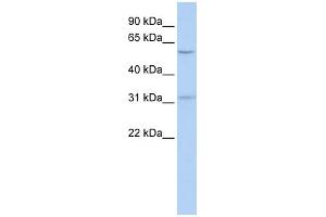 WB Suggested Anti-BTBD14B Antibody Titration:  0. (NAC1 抗体  (Middle Region))