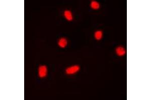 Immunofluorescent analysis of BAF53A staining in K562 cells. (BAF53A 抗体  (Center))