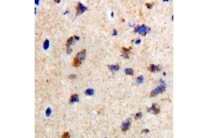 Immunohistochemical analysis of CCDC52 staining in rat brain formalin fixed paraffin embedded tissue section. (SPICE1 抗体)