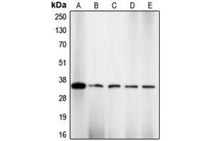 Western blot analysis of CDK2 (pT160) expression in NIH3T3 (A), HeLa (B), COLO205 (C), K562 (D), A2780 (E) whole cell lysates. (CDK2 抗体  (pSer160))