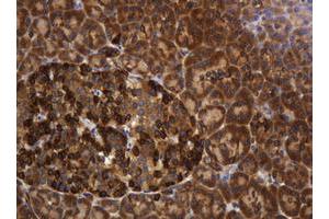 Image no. 7 for anti-TAP Binding Protein-Like (TAPBPL) antibody (ABIN1501302)