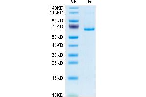 SDS-PAGE (SDS) image for EPH Receptor B3 (EPHB3) (AA 30-554) protein (His tag) (ABIN7274566)