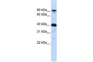Western Blotting (WB) image for anti-Cysteinyl-tRNA Synthetase (CARS) antibody (ABIN2458484) (CARS 抗体)