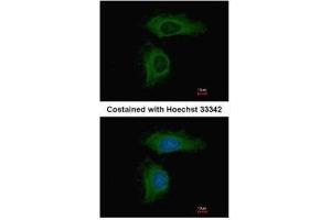 ICC/IF Image Immunofluorescence analysis of methanol-fixed HeLa, using PPP2R1A, antibody at 1:500 dilution. (PPP2R1A 抗体  (Center))