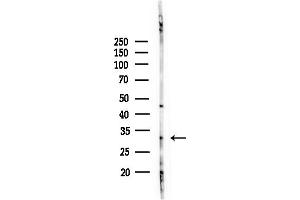 Western blot analysis of lysates from Rat brain, using Cathepsin L Antibody at 1/1000 dilution.