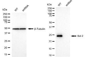 Western blotting analysis using Bcl-2 antibody (ABIN7797718). (Recombinant Bcl-2 抗体)