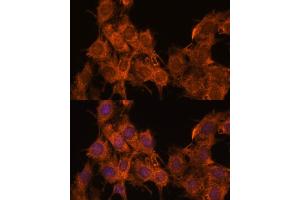 Immunofluorescence analysis of C6 cells using SNX15 antibody  at dilution of 1:100. (SNX15 抗体  (AA 1-342))