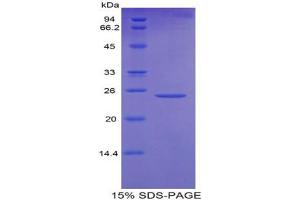 SDS-PAGE analysis of Mouse OSF Protein.