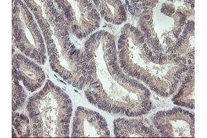 Image no. 1 for anti-Keratin Associated Protein 2-4 (KRTAP2-4) (AA 1-128) antibody (ABIN1490568) (KRTAP2-4 抗体  (AA 1-128))