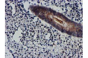 Immunohistochemical staining of paraffin-embedded Human endometrium tissue using anti-AKT1 mouse monoclonal antibody. (AKT1 抗体)