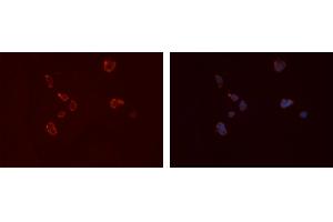 ABIN6276667 staining Hela cells by IF/ICC. (FCGR2A 抗体  (C-Term))