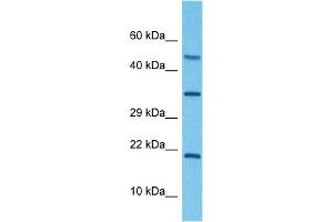 Western Blotting (WB) image for anti-ATPase, H+ Transporting, Lysosomal 16kDa, V0 Subunit C (ATP6V0C) (Middle Region) antibody (ABIN2773857)