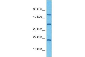 Host:  Rabbit  Target Name:  ATP6V0C  Sample Tissue:  Human RPMI 8226 Whole Cell  Antibody Dilution:  1ug/ml (ATP6V0C 抗体  (Middle Region))