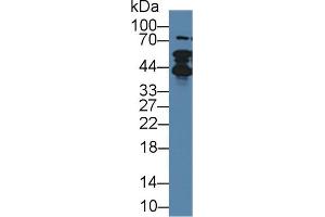 Western blot analysis of Human Lung lysate, using Rabbit Anti-Human TMPO Antibody (1 µg/ml) and HRP-conjugated Goat Anti-Rabbit antibody (abx400043, 0. (Thymopoietin 抗体  (AA 1-243))