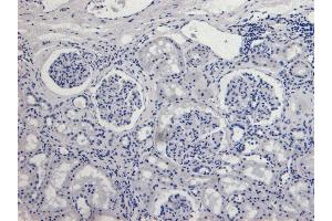(ABIN2613375) Negative Control showing staining of paraffin embedded Human Kidney, with no primary antibody. (AIF 抗体  (AA 183-195))
