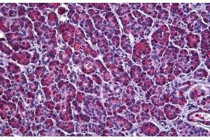 Human Pancreas: Formalin-Fixed, Paraffin-Embedded (FFPE) (Ataxin 1 抗体  (AA 742-791))