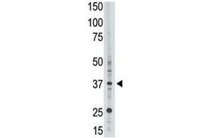 EPR1 antibody used in western blot to detect EPR1 in HL-60 cell lysate (EPR1 抗体  (AA 308-337))