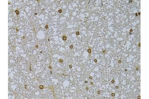 Immunohistochemistry of paraffin-embedded rat spleen using HDGFRP3 Rabbit pAb (ABIN6133452, ABIN6141699, ABIN6141700 and ABIN6224799) at dilution of 1:150 (40x lens). (HDGFRP3 抗体  (AA 90-203))