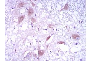 Image no. 1 for anti-DKK3 antibody (ABIN1491710) (DKK3 抗体)
