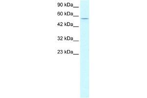 WB Suggested Anti-CCNL1 Antibody Titration: 2. (Cyclin L1 抗体  (N-Term))
